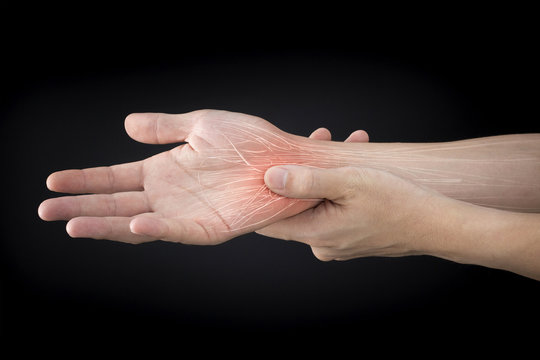 Karpalband Bilder Durchsuchen 110 Archivfotos, und