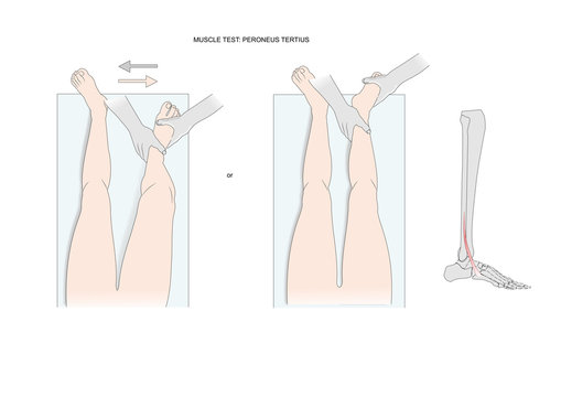 muscle testing: peroneus (tertius). Test used in kinesiology, neurology, physical therapy