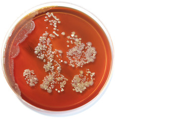 Petri dish with colonies of bacteria