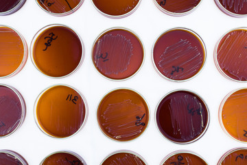 Petri dishes in a row on a white background. Petri dishes with bacterial colonies top view.