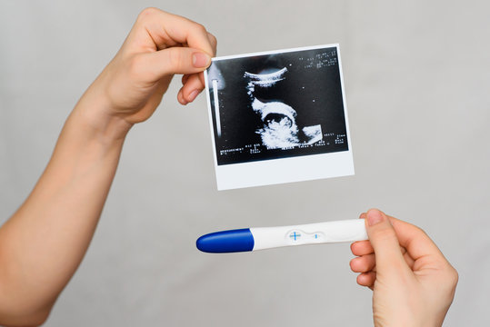 ultrasound picture and positive pregnancy test in the hands of a girl close-up