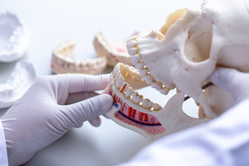 Study cast of Diagnostic cast and dental gypsum models in dental laboratory.