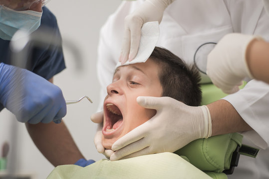 Terrified teenager boy is being checked at the dentist while being held by three doctors - oral hygiene health care concept