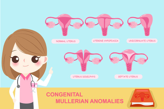 congenital mullerian anomalies