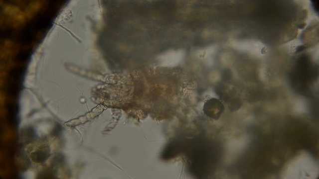 dust, water mite under a microscope