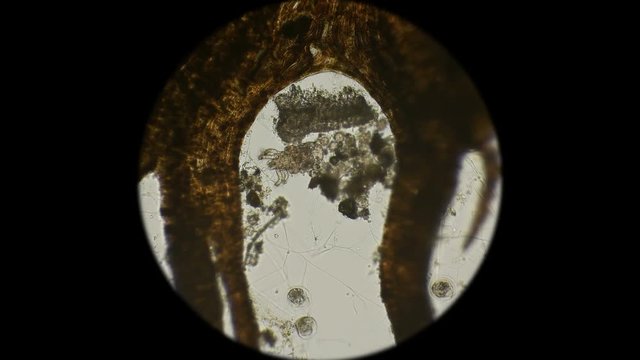 dust, water mite under a microscope