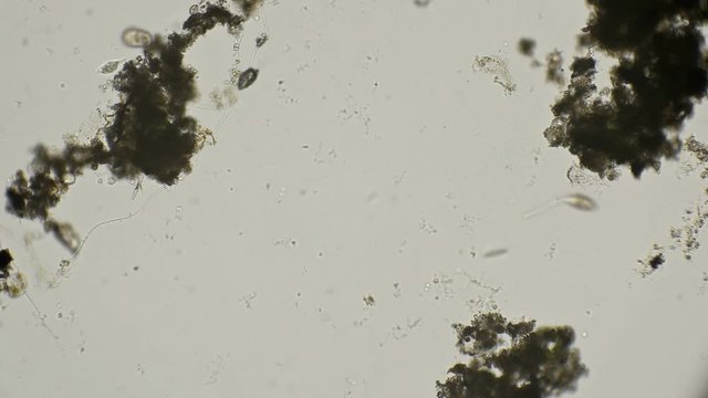 infusoria lacrimaria to hunt and quickly moves under a microscope