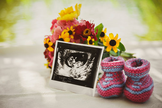 Close up of ultrasound picture, photo of the future baby at belly and small baby shoes