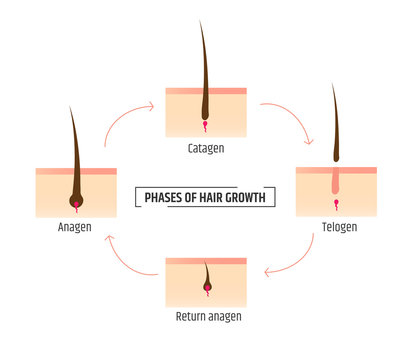 Hair Growth Phases. Infographics Trichology And Dermatology. Laser Hair Removal