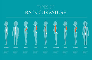 Types of back curvature. Medical desease infographic