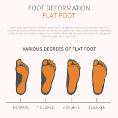Fototapeta premium Foot deformation as medical desease infographic. Causes of Flat foot
