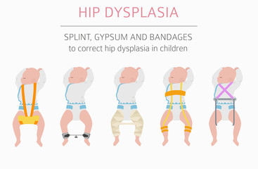 Foot deformation types,  medical desease infographic. Hip dysplasia in children
