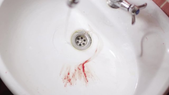 ripped out the wisdom tooth, bleeding wound