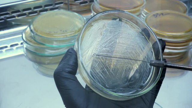 A close-up of the selection of bacteria from one cup and seeding with a bacteriological loop on another cup. The work of a microbiologist in the laboratory.
