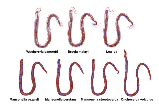Comparison of microfilariae morphology, 3D illustration showing sheathed and unsheathed microfilaria worms differing also by tail nuclei location