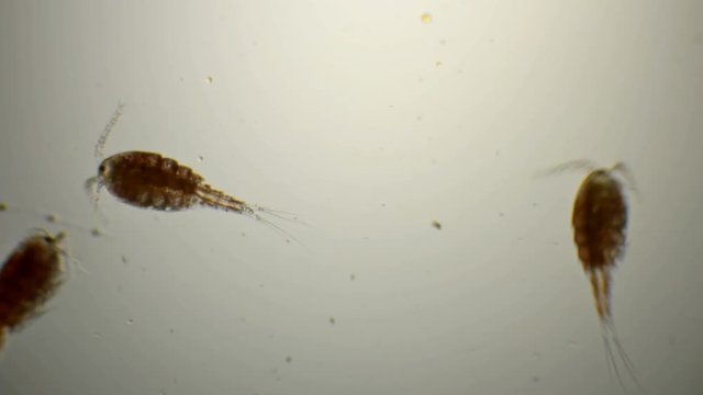 female Cyclops with egg sacks under microscope