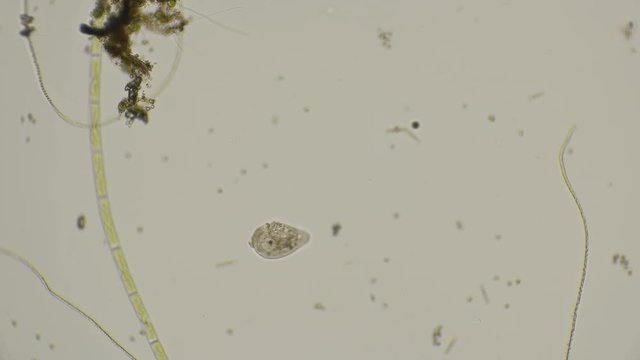 ciliated infusoria under a microscope