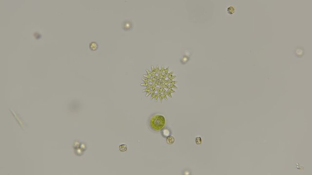 beautiful pattern of diatom algae under a microscope