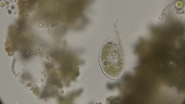 ciliated infusorians under a microscope