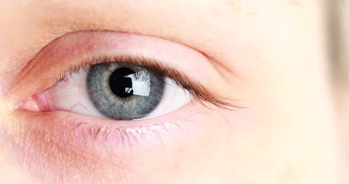 pupil enlargement in the woman eye detail