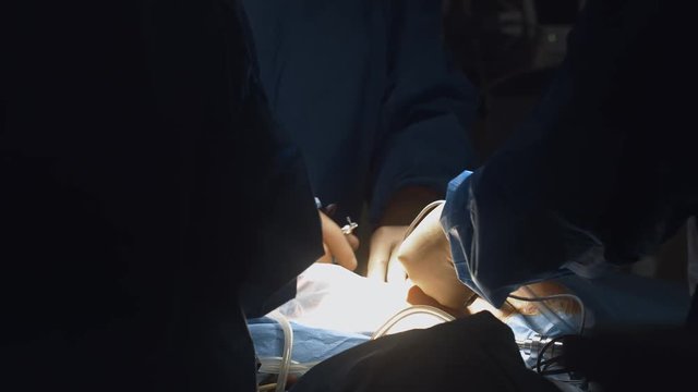 Operating room, team of surgeons prepares patient to cancer removal surgery via Minimally Invasive Robotic Surgery with the Surgical System. Hi-tech medical robot. Close up