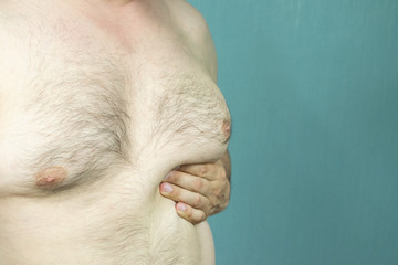 fat white middle-aged man with Gynecomastia, enlarged breast close-up