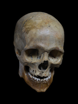 Skull of the human