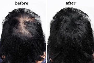 Female hair after using cosmetic powder for hair thickening. Before and after
