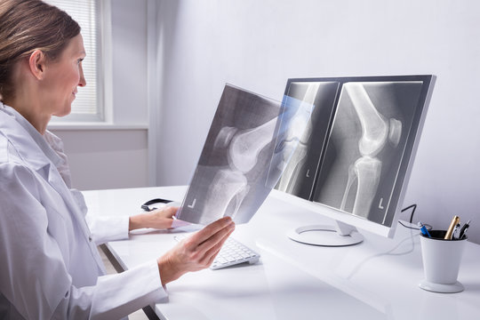 Doctor Examining Knee X-ray
