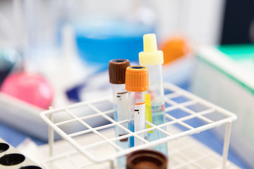 Symbolbild Blutprobe