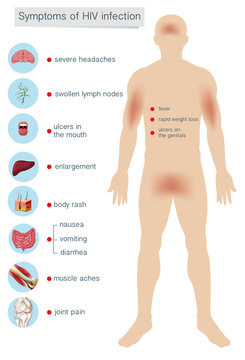 Human Anatomy Symptoms of HIV Infection