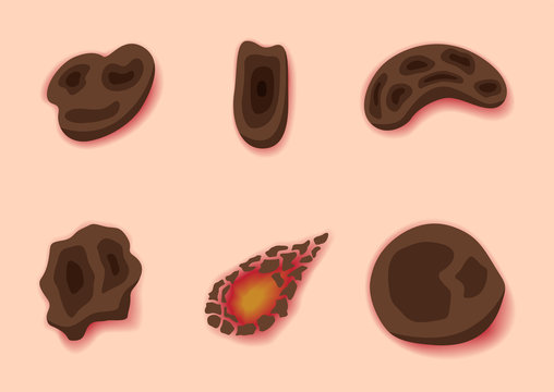 scab skin , wound , bleeding vector