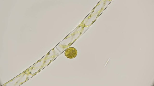 filamentous algae Spirogrya under the microscope