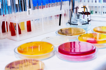 Petri dish. Microbiological laboratory. Mold and fungal cultures. Bacterial research