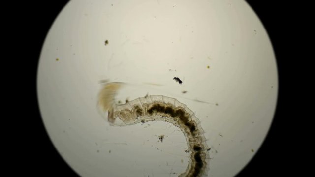 worm of the family Naididae, Pristina longiseta under the microscope