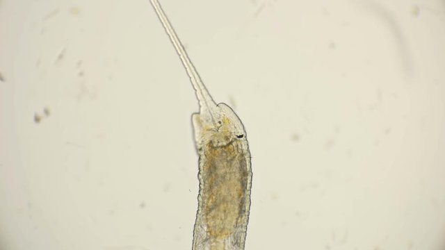 worm of the family Naididae, Pristina longiseta under the microscope