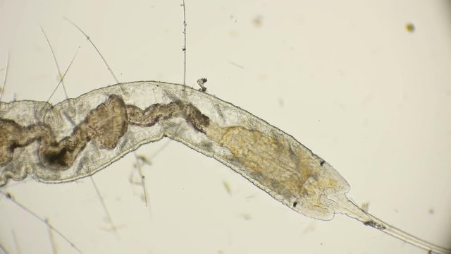 worm of the family Naididae, Pristina longiseta under the microscope