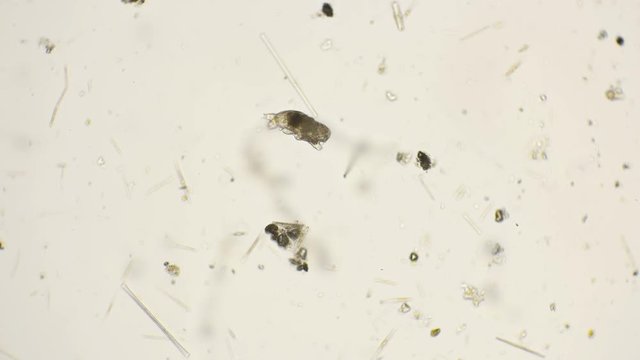the most enduring organism on the planet is the slow-moving, under a microscope