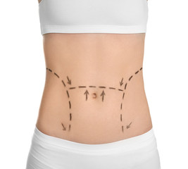 Young woman with marks on belly for cosmetic surgery operation against white background