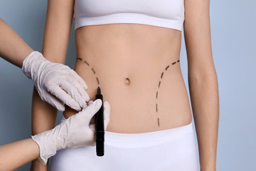Doctor drawing marks on female belly for cosmetic surgery operation, closeup