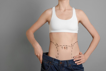 Young woman with marks on belly in big jeans after cosmetic surgery operation against color background