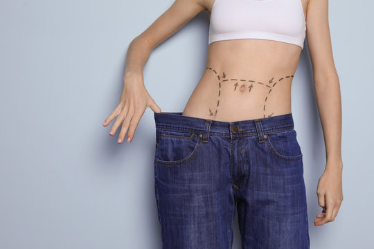 Young woman with marks on belly in big jeans after cosmetic surgery operation against color background
