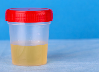 Medical urine test in plastic container