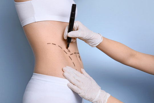 Doctor drawing marks on female belly for cosmetic surgery operation against color background