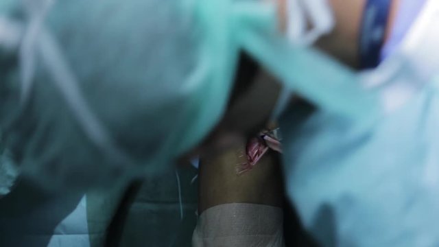 Surgeons cutting into knee, close up