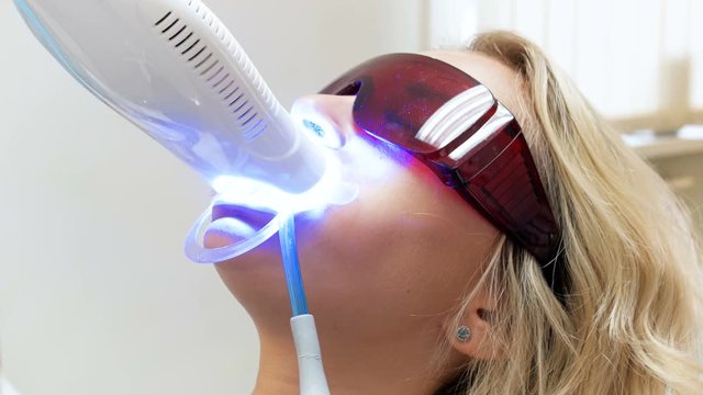 Closeup 4k video of blonde young woman lying in dentist chair during teeth whitening procedure