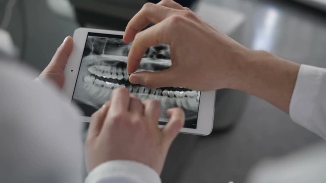 Close-up of dentists's hands holding and using tablet pc. Medical doctors discussing patient's diognosis and teeth problems on the basis of dental x-ray on touchpad at dental office