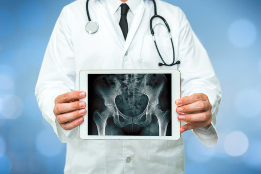 Doctor showing a x-ray of hips on digital tablet with red cross emergency on a blue background