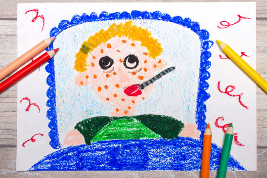 Photo of colorful drawing: sad sick boy lies in a bed. Boy with a rash on his face and a thermometer in his mouth
