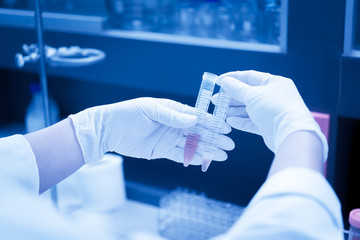 Scientist mix chemicals with The shake machine Before the experiment.Mixture laced with samples into test tubes,Thailand scientist working in the lab